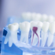 Endodontie | Zahnarzt Gunnar Gansen Schönwalde